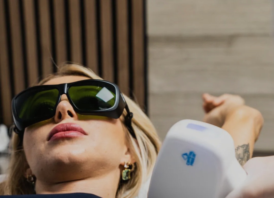 Laser treatment at Sorellina Clinic