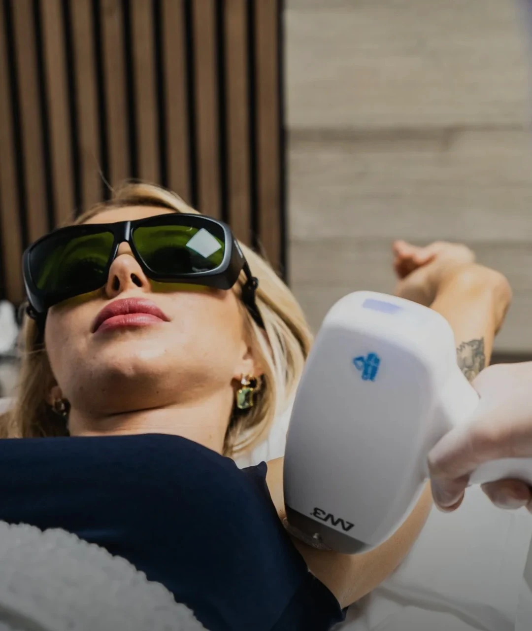 Laser hair removal treatment in progress at Sorellina Clinic