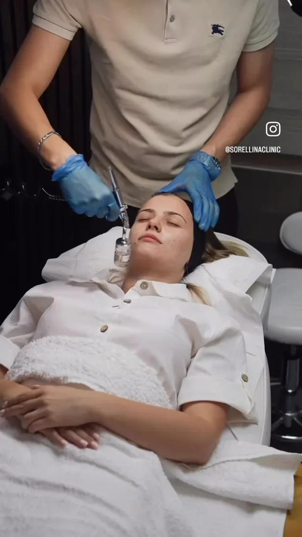 A QUAD Hydra Facial in progress at Sorellina Clinic