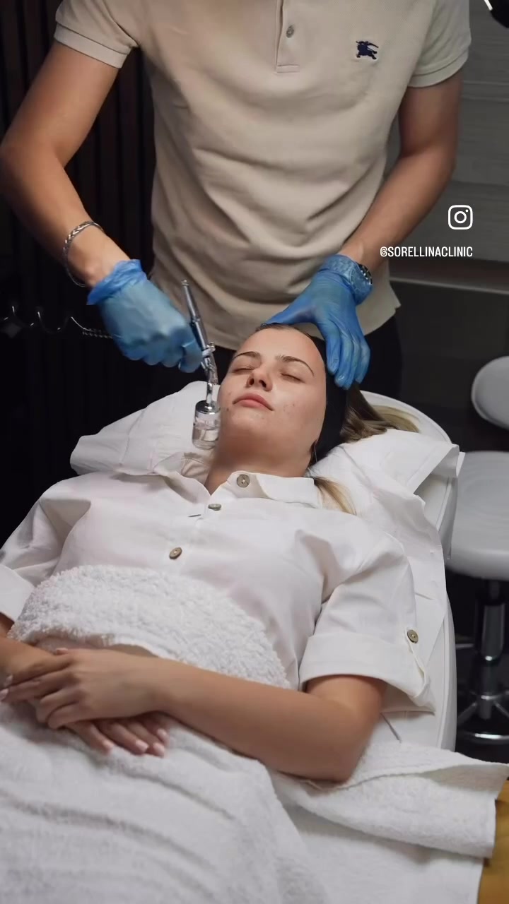 QUAD Hydra Facial being performed at Sorellina Clinic