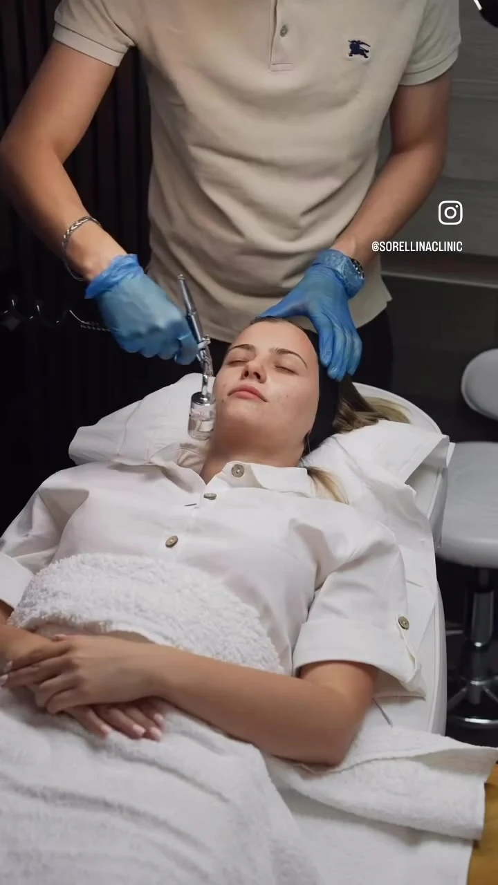 QUAD Hydra Facial being performed at Sorellina Clinic